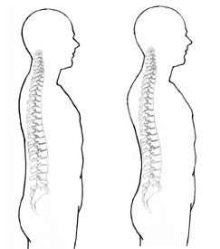 spine_compt.jpg